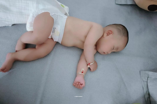 莱州宝宝头上长痱子